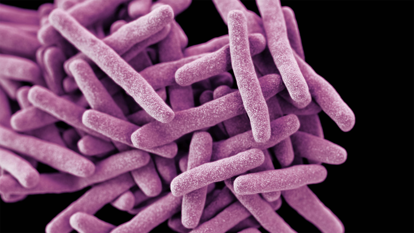 Researchers develop new method for studying TB, other organisms that go dormant